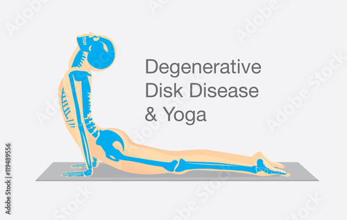 Human bone anatomy while Yoga workout in cobra posture. This illustration about degenerative disk disease therapy with Yoga.