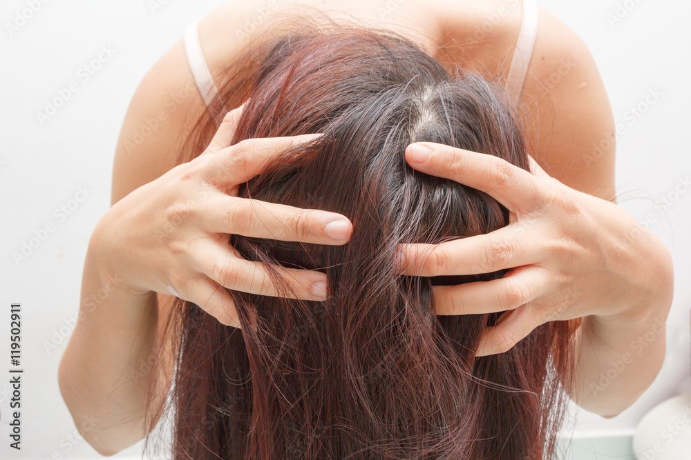 Fototapeta premium Women itching scalp