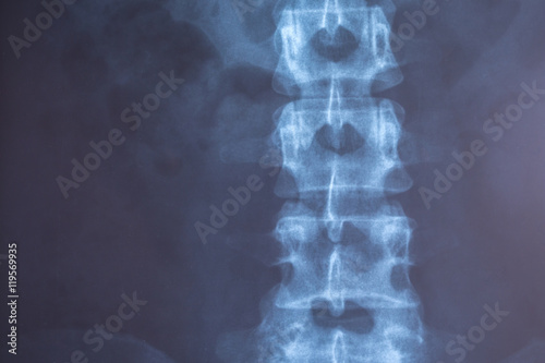 X-Ray image of human for a medical diagnosis