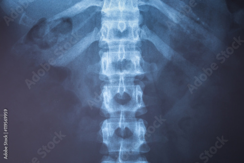 X-Ray image of human for a medical diagnosis