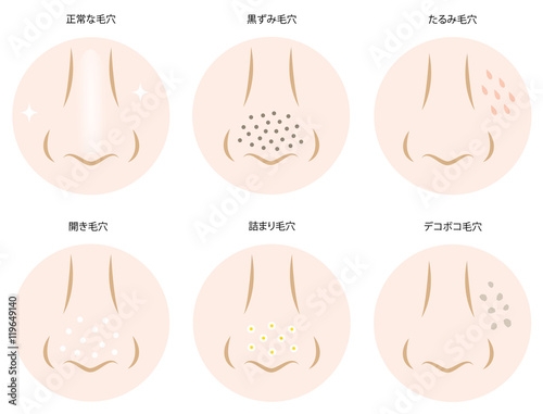 毛穴