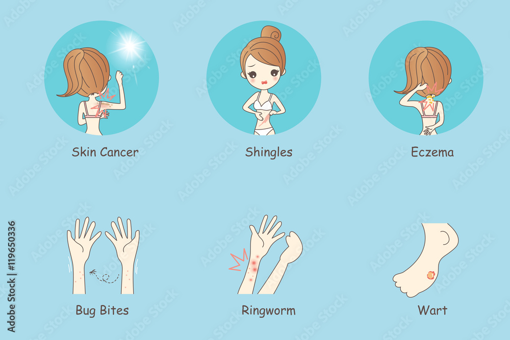 cartoon woman has skin problem cartoon woman has skin problem