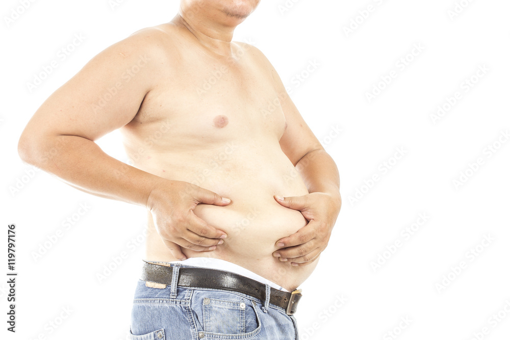 Naklejka premium Obesity caused by eating hamburgers and soft drinks containing sugar and starch content than the body needs. Caused by various diseases. And seemed to wear due to excessive weig