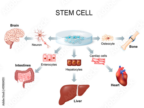 Using stem cells to treat disease