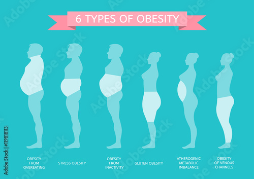 6 Types of Obesity. Male and female figure in profile
