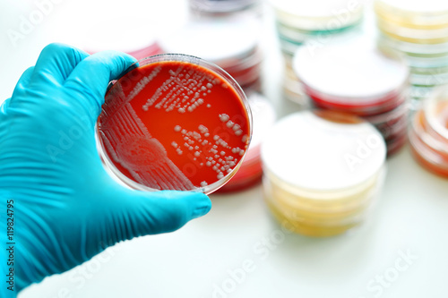 Bacteria culture in petri dish photo