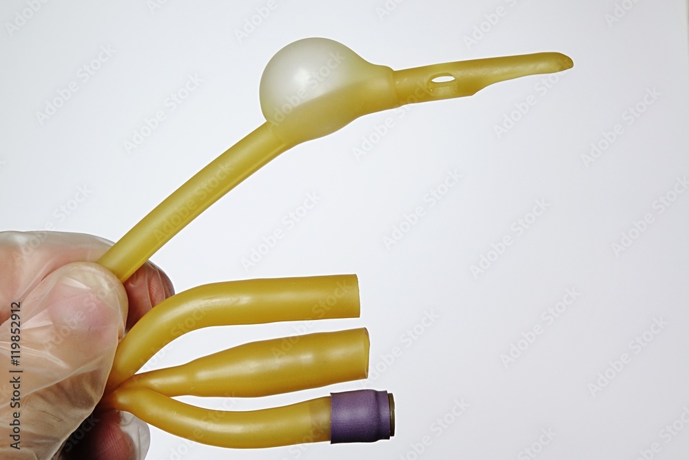 Wat Is Een Couvelaire Catheter