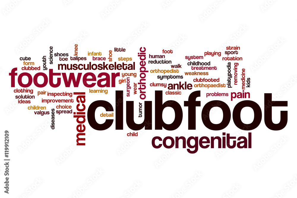 Clubfoot word cloud