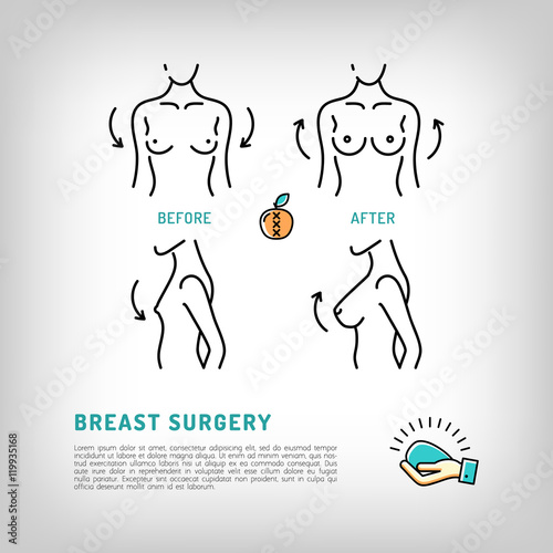 Augmentation Breast surgery logos, silicone implants. Body Plastic surgery concept thin line icons. Medical symbols and cosmetic surgery before and after. Vector illustration