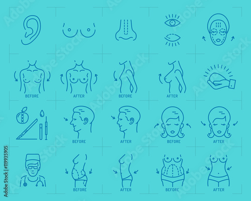 Plastic surgery concept thin line art icons. Medical symbols and plastic surgery before and after: breast augmentation, liposuction, blepharoplasty, rhinoplasty and otoplasty. Vector illustration