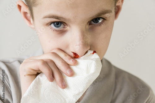 One serious boy uses tissue to stop bleeding nose