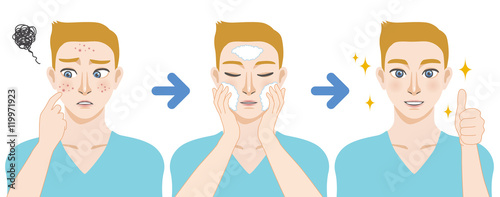 young boy acne treatment before and after, facial cleansing foam, men's skin care, cartoon illustration