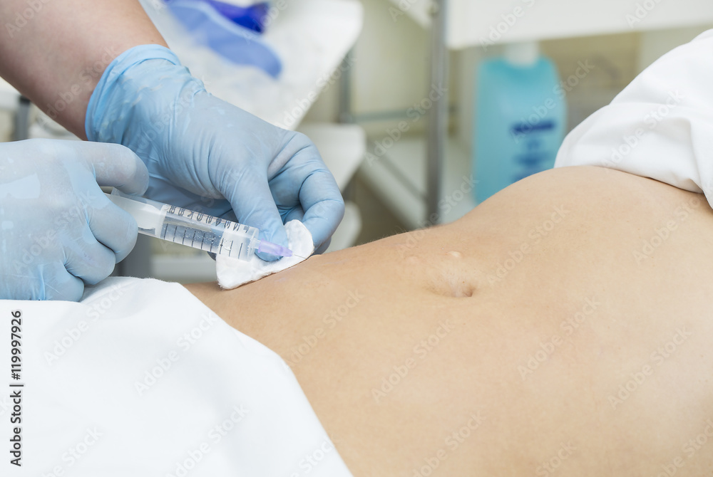 woman is in the process cellulite mesotherapy clinic woman is in the process cellulite mesotherapy clinic