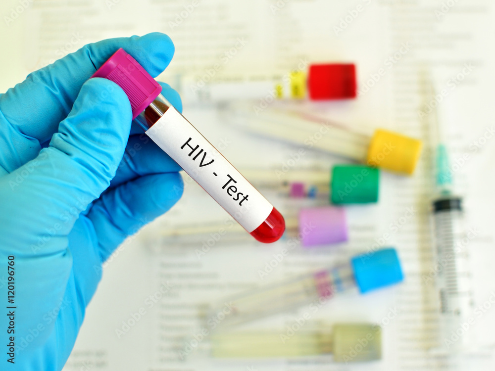 Naklejka premium Blood for HIV test