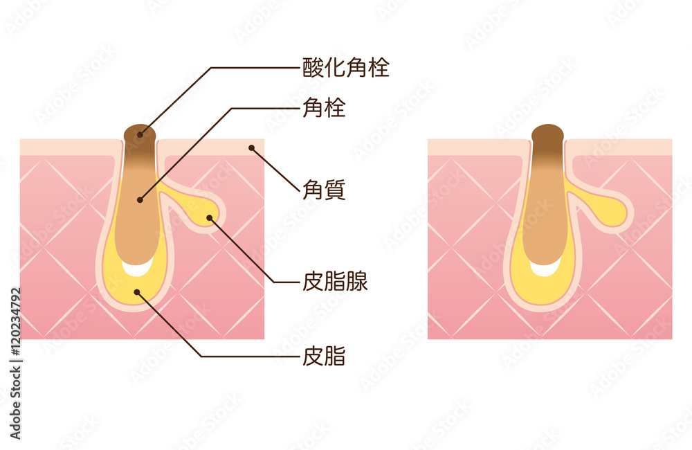 毛穴の構造 角栓 断面図 Stock Illustration Adobe Stock
