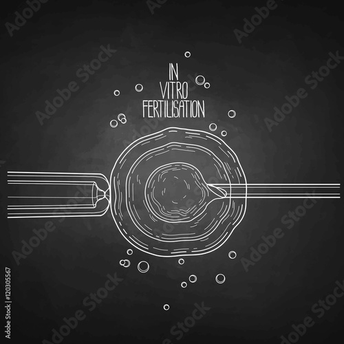In vitor fertilisation