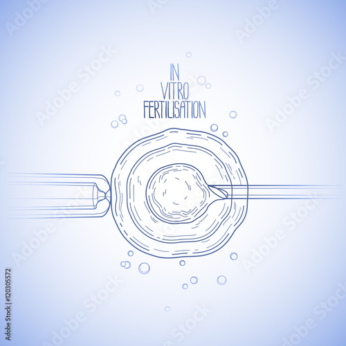 In vitor fertilisation