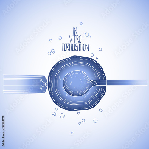 In vitor fertilisation