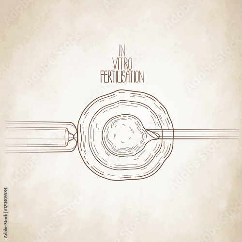 In vitor fertilisation