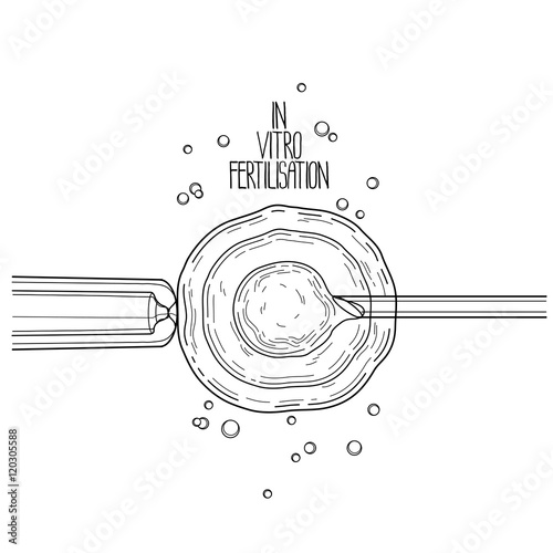 In vitor fertilisation