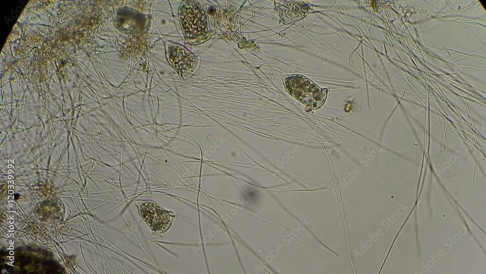 vorticella and rotifers filtrating water under microscope 400x vídeo do ...