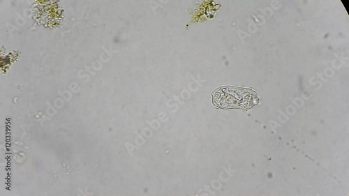 Living cells infusoria under microscope