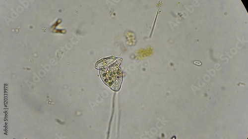 vorticella filtrating water under microscope 400x photo