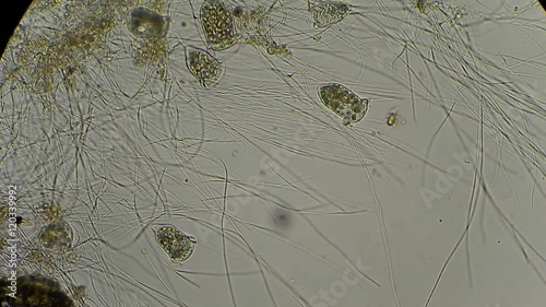 vorticella and rotifers filtrating water under microscope 400x