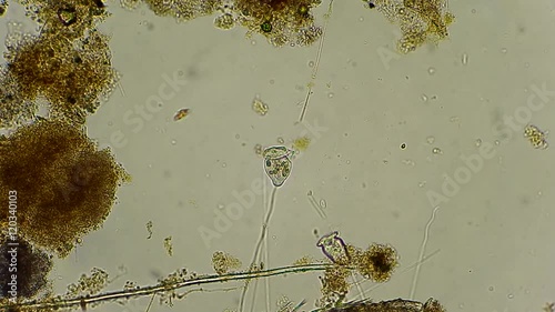 vorticella and rotifers filtrating water under microscope 
