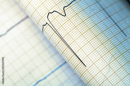 Wallpaper Mural ECG graph, medical textured background Torontodigital.ca