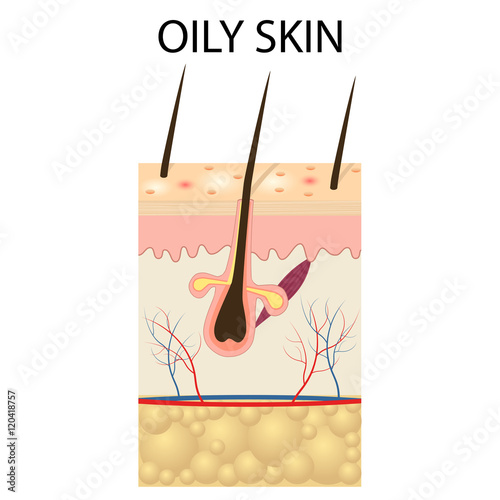 Illustration of The layers of oily skin