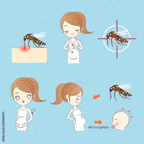 zika virus and pregnant women