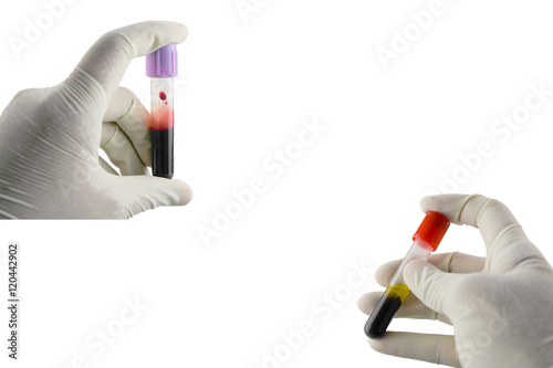 Hematology And Immunology Blood Requisition For Hiv In Laboratory Specimen In Clot Blood Tube And Edta Blood Tube Collection Have Clipping Path Stock Photo Adobe Stock