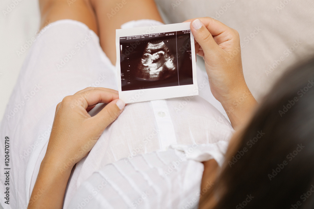 Pregnant woman holding ultrasound scan Pregnant woman holding ultrasound scan