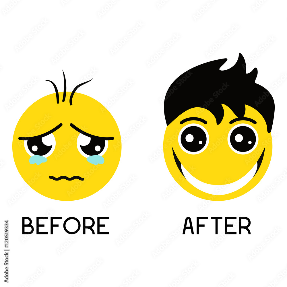 Sad balding emoticon before hair treatment and happy smiley with gorgeous  hair after hair regrowth. Set of emoticons isolated on a white background.  Hair care concept. Emoji vector illustration. Stock Vector |