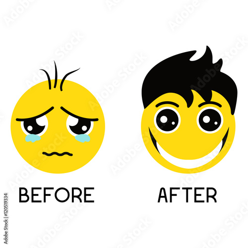 Sad balding emoticon before hair treatment and happy smiley with gorgeous hair after hair regrowth. Set of emoticons isolated on a white background. Hair care concept. Emoji vector illustration.