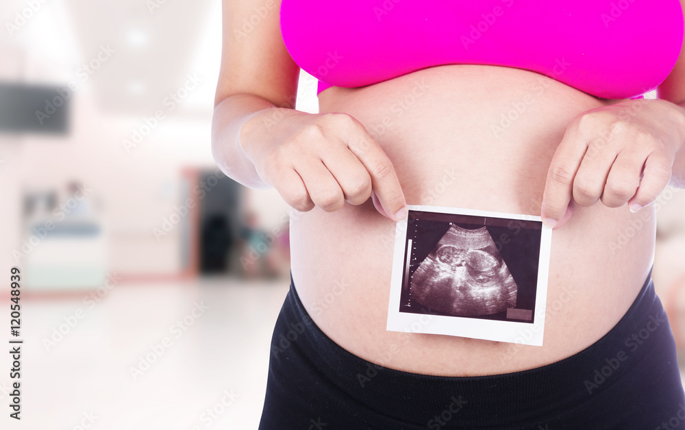 Pregnant woman hands holding ultrasound photo in hospital backgr Pregnant woman hands holding ultrasound photo in hospital backgr