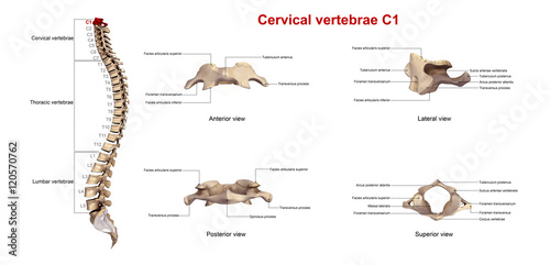 Cervical vertebrae C1_With Lables