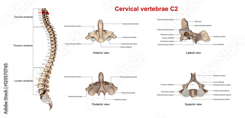 Cervical vertebrae C2_With Lables