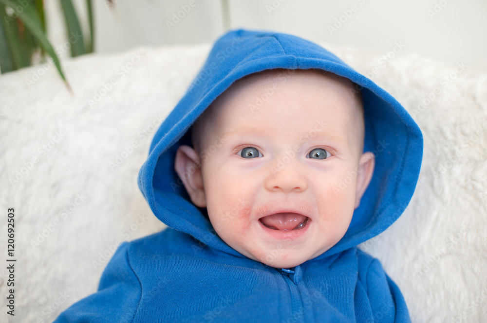 Boy with atopic dermatitis smiles and rejoices Boy with atopic dermatitis smiles and rejoices
