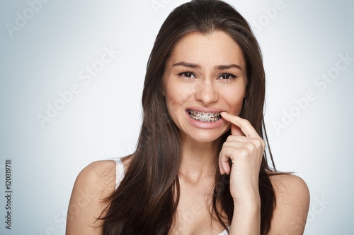 Twarz młodej kobiety z szelkami na zębach