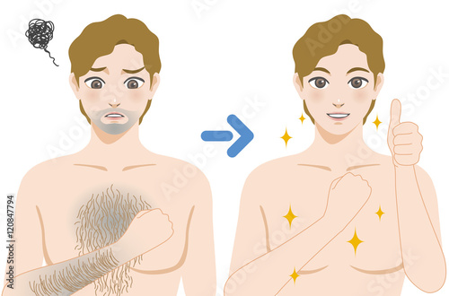 men'a hair removal before after concept, unwanted hair, superfluous hair, vector illustration