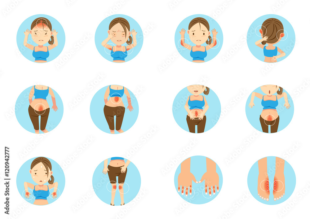 Psoriasis/Sick woman main areas of the human body affected by psoriasis. Cartoon vector illustration Psoriasis/Sick woman main areas of the human body affected by psoriasis. Cartoon vector illustration