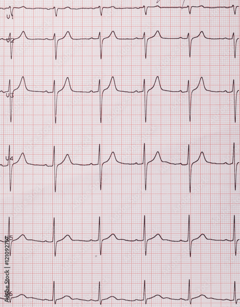 Naklejka premium Heart beats cardiogram