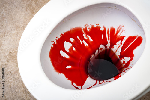 Splattered blood in a toilet bowl representing a bloody stool, a sign of dangerous medical issues like hemorrhoids,  peptic ulcers, angiodysplasia, gastroenteritis,  anal fissure, colitis, cancer, etc photo