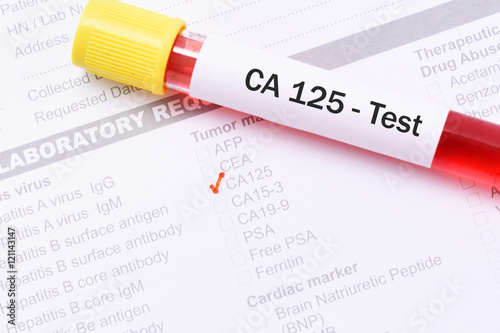 Blood for CA 125 test, tumor marker for ovarian cancer