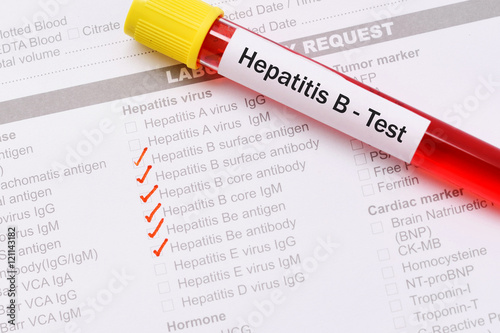 Blood sample for hepatitis B test