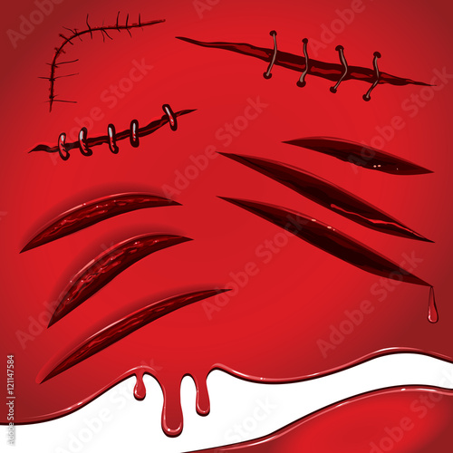 Red blood stains bruising set of wounds sewn scars and scratches all the elements separately on a red background