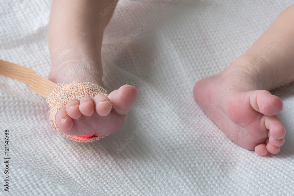 Pulse oximeter sensor on the feet of newborn baby in a hospital bed