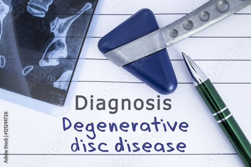 Konstfotografi Diagnosis degenerative disc disease